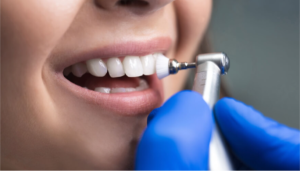 Best Dental Insurance in Sydney