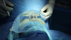 Nose Job in Dubai